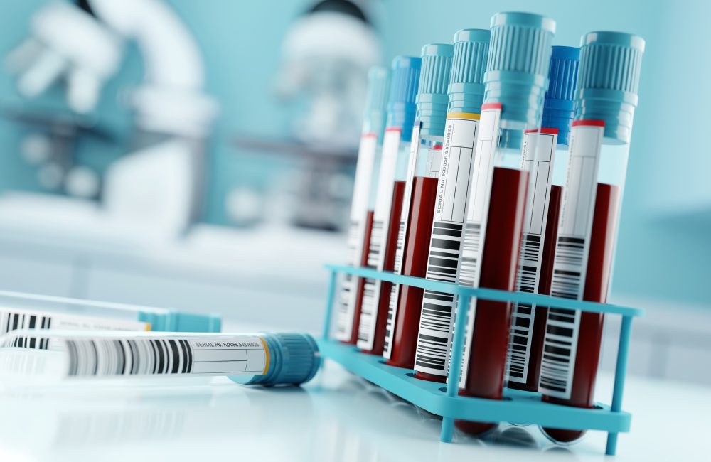 Blood samples and test results in a clinical medical laboratory. 3D illustration